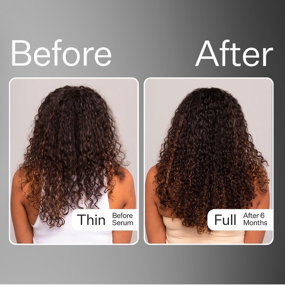 ๐ ACT+ACRE Cold Processed Stem Cell Scalp Serum 30ml - Picture 6 of 12